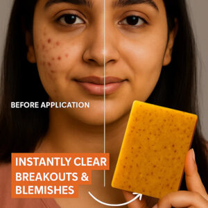 Alisanda™ soap : Rich in Vitamin C, retinol, collagen